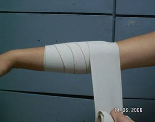 pentru leziunile articulației cotului, aplicați un bandaj