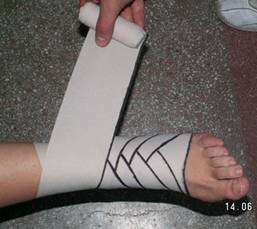 Pansamente pentru tratamentul articulațiilor genunchiului
